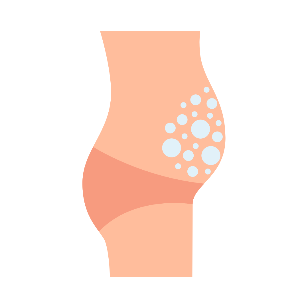 Illustratie opgeblazen buik na het eten – Floohw