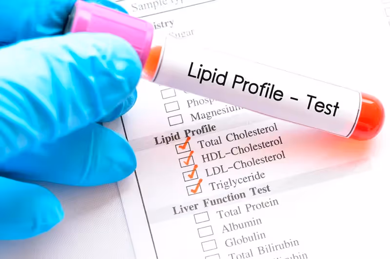 Hipertrigliceridemia: da fisiologia ao tratamento
