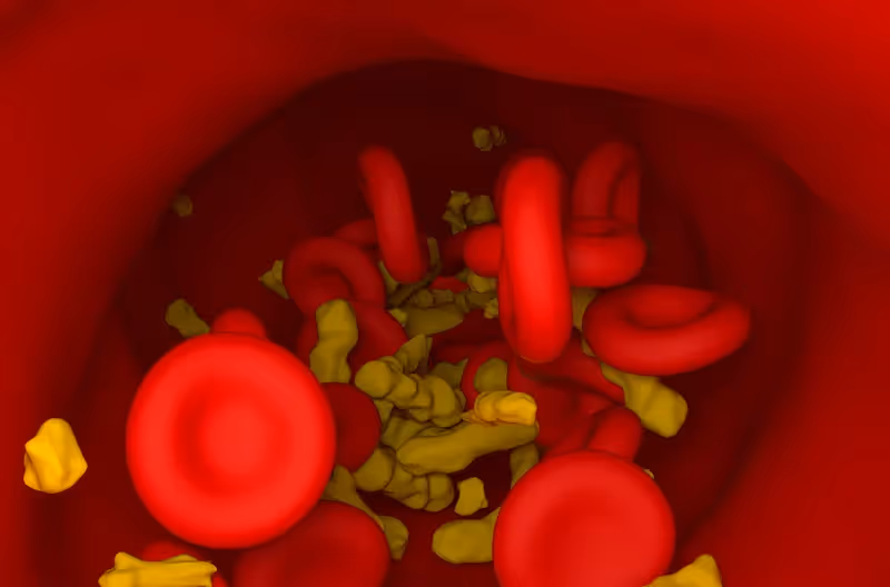 Entenda o que é a hipercolesterolemia, a fisiologia e o tratamento