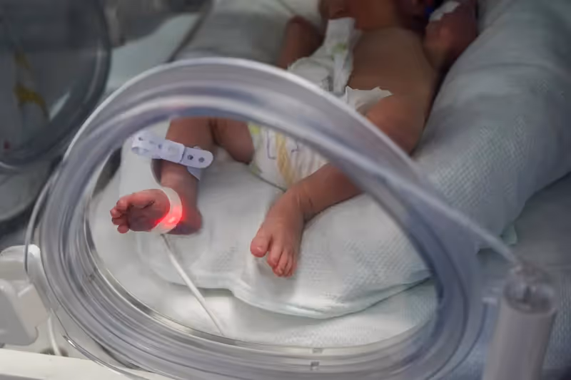 O Que É Prematuridade e Complicações Que Levam ao Parto Prematuro