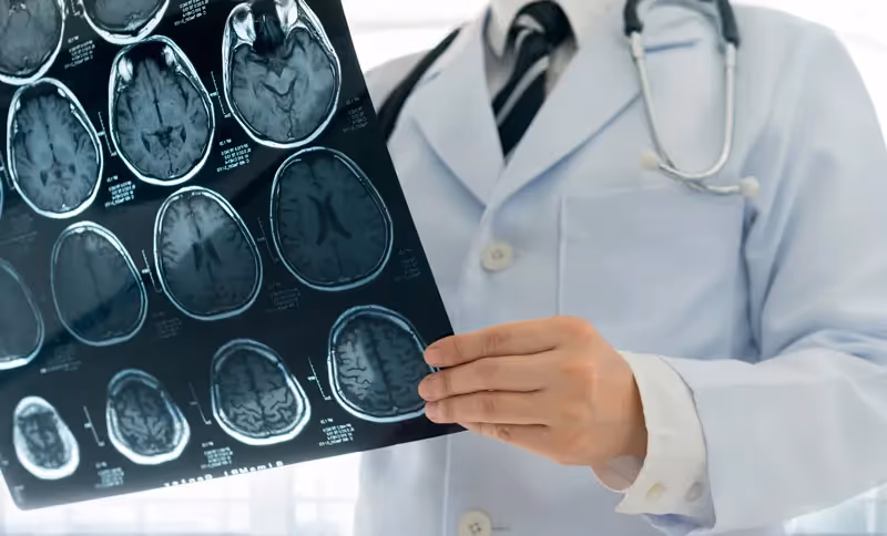 Você domina o manejo do acidente vascular cerebral isquêmico (AVCi)?