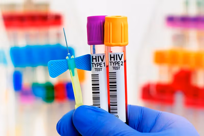 Conheça o HIV 1 e 2 e entenda as diferenças, sintomas e tratamentos