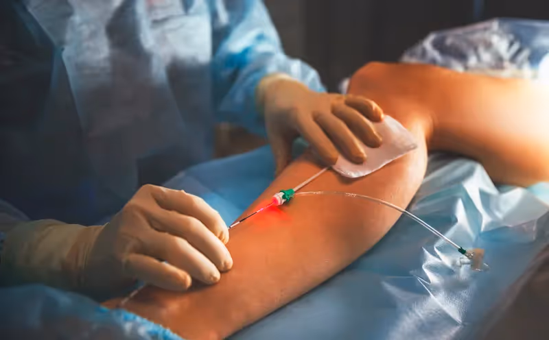 Saiba o que é a Cirurgia Vascular e conheça os diferente tipos e métodos
