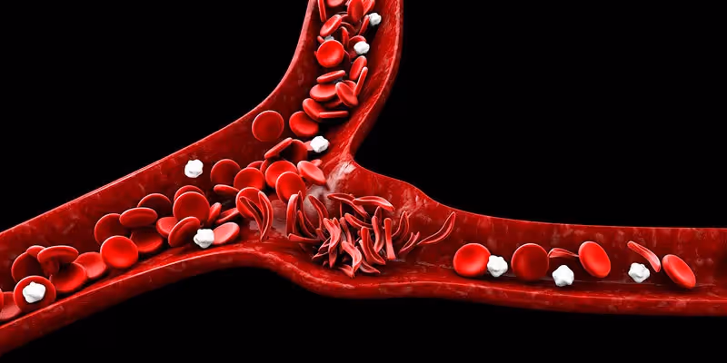 O que é anemia falciforme, seus principais sintomas e tratamento