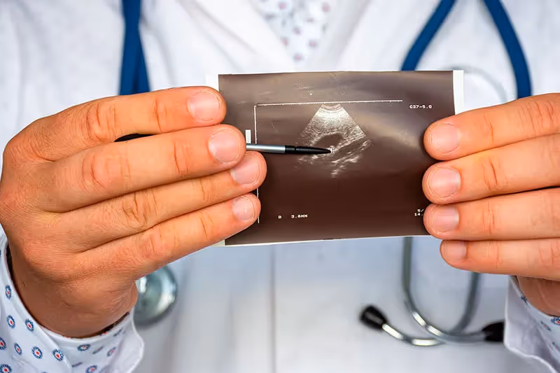 Câncer de Vesícula Biliar: como Diagnosticar, Sintomas e Estadiamento