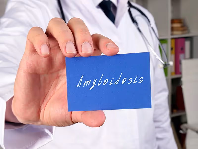 Amiloidose: o que é, principais sintomas e achados diagnósticos