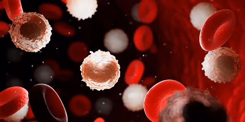 Câncer de Medula Óssea: principais tipos, quais são os sintomas e como tratar
