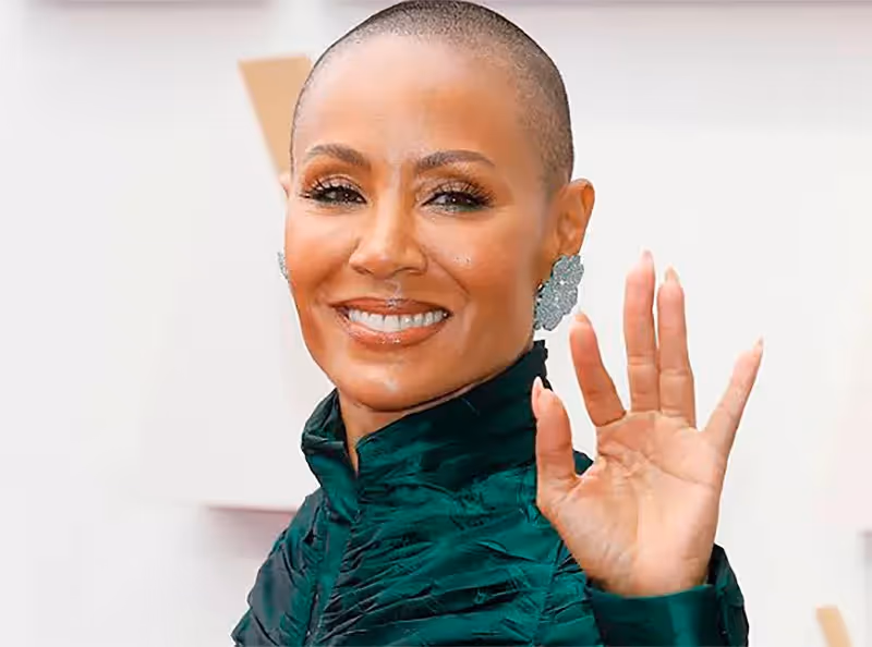 Alopecia: quais são seus tipos e como tratar