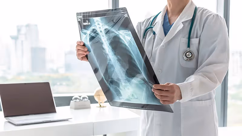 Derrame Pleural: o que é, causas e tratamento
