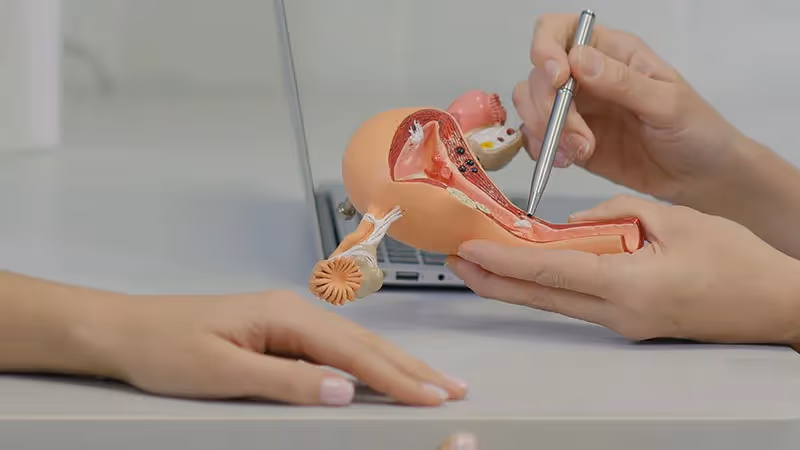 Câncer de endométrio: fatores de risco, sintomas e tratamento