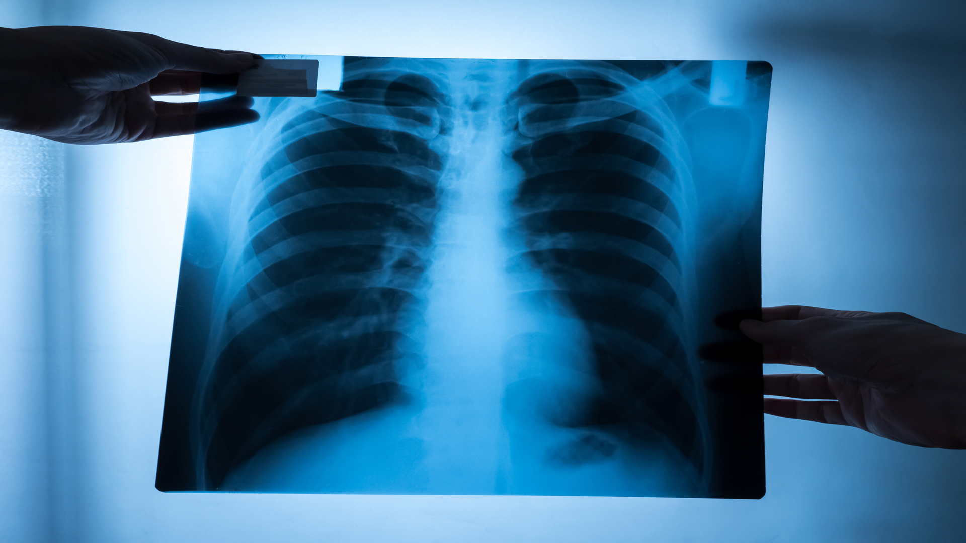 A rotina do residente em pneumologia inclui o acompanhamento em exames. Foto: Reprodução/Envato