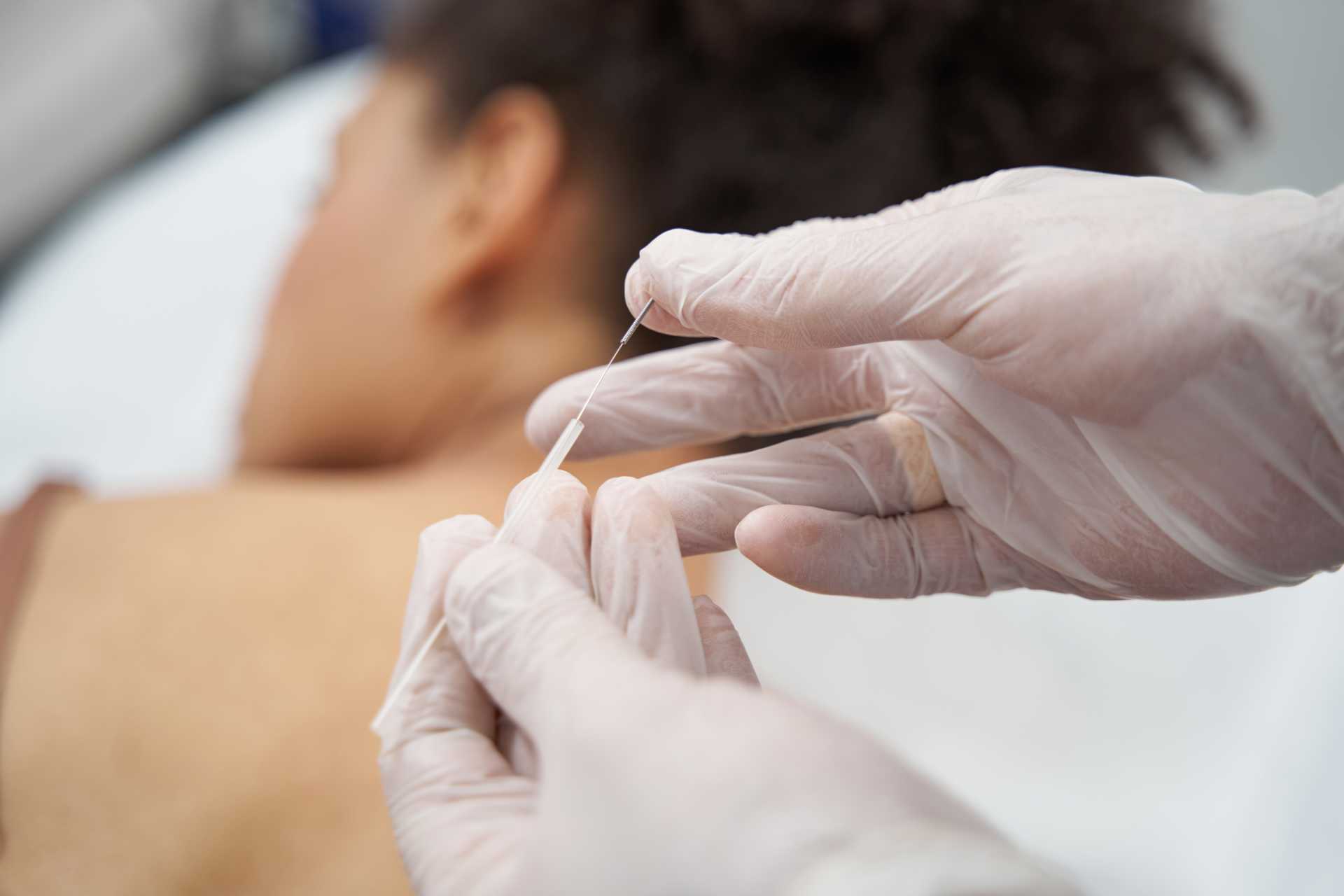 O médico especialista em Acupuntura lida com variadas condições que podem incluir dores crônicas, dores pós-operatórias e até mesmo problemas psíquicos e emocionais. Foto: Reprodução/Envato