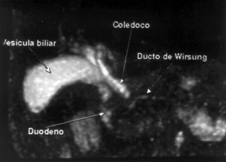 Exemplo de CPRE. Fonte: Revista da Associação Médica Brasileira