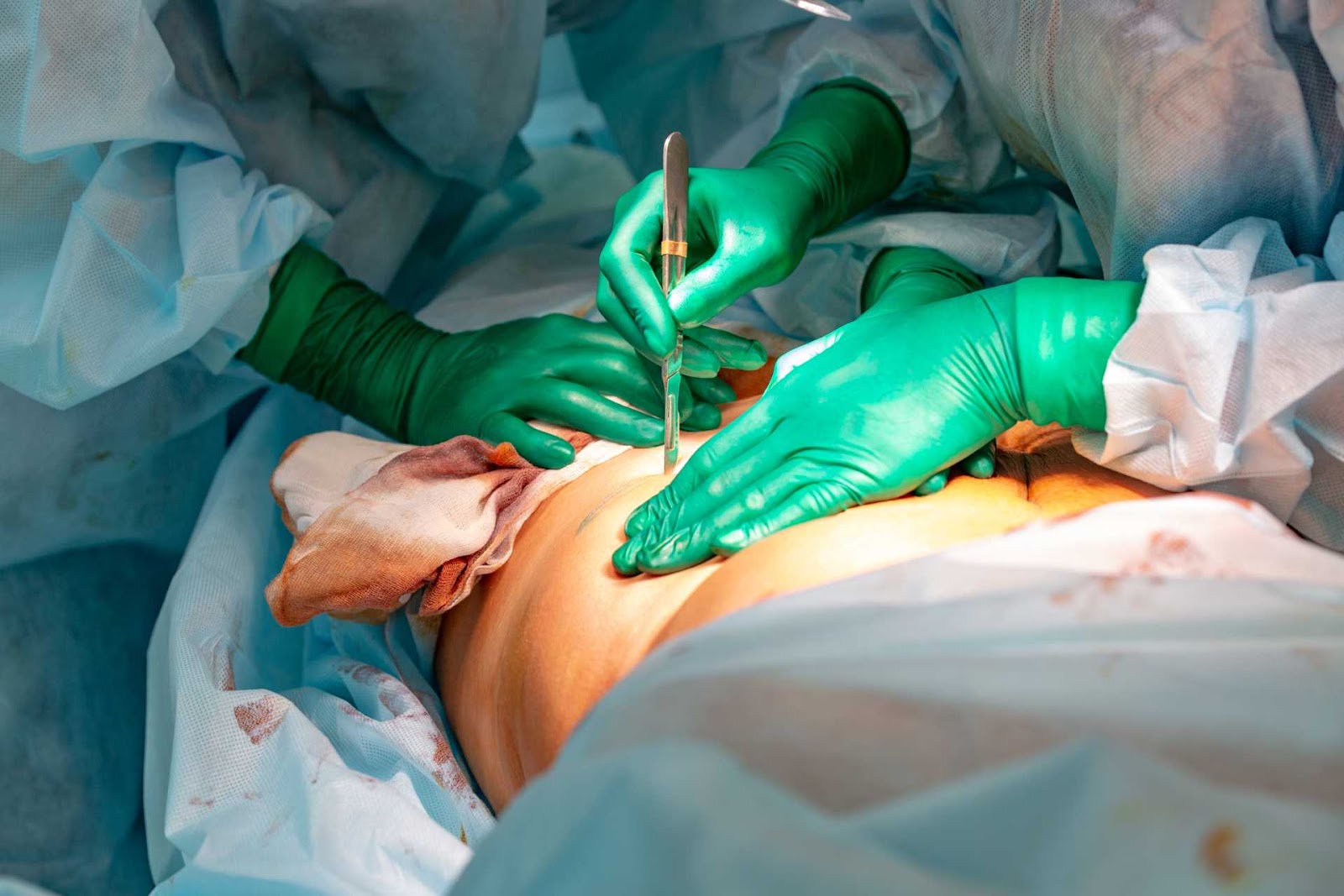 A residência em Cirurgia do Aparelho Digestivo tem duração de dois anos e possui programas em todas as regiões do país. Foto: Reprodução/AdobeStock