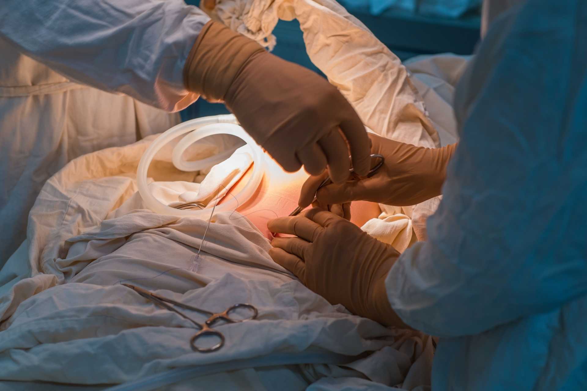 A Cirurgia do Aparelho Digestivo trata as doenças através dos procedimentos cirúrgicos. Foto: Reprodução/AdobeStock