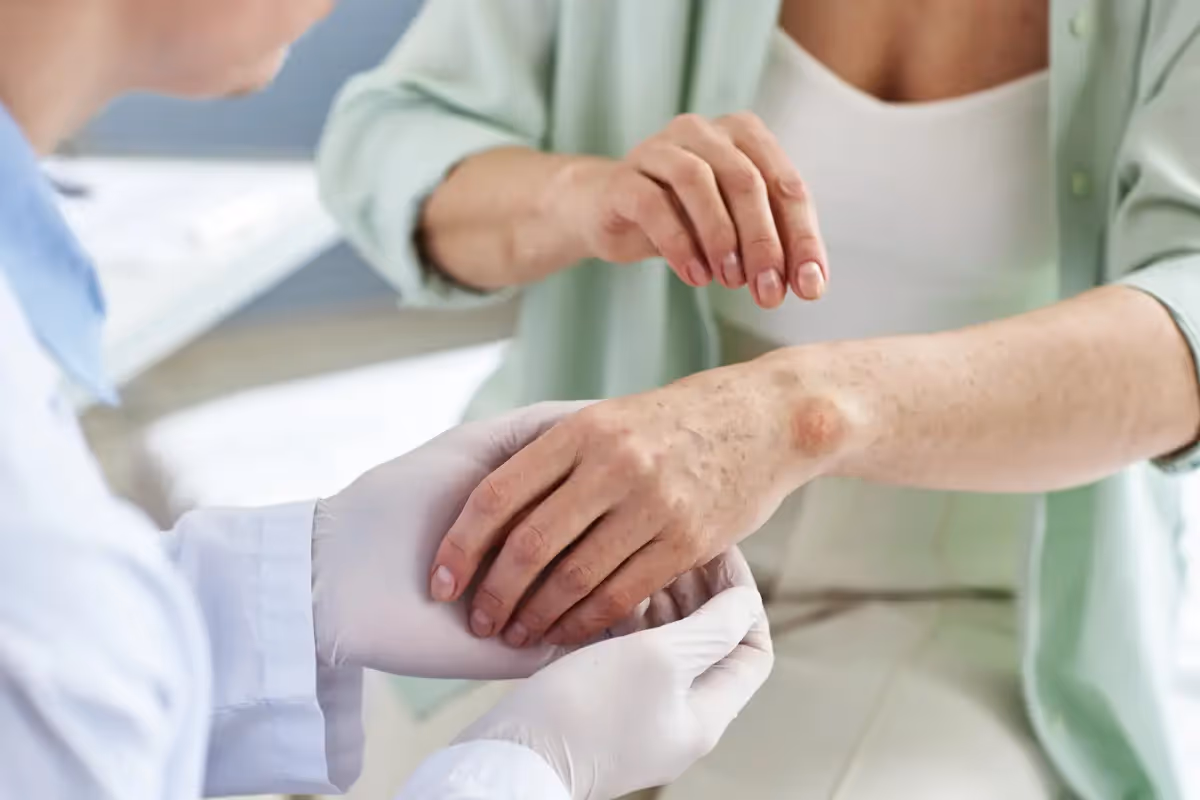 Tudo sobre pênfigo para a prova de residência médica 