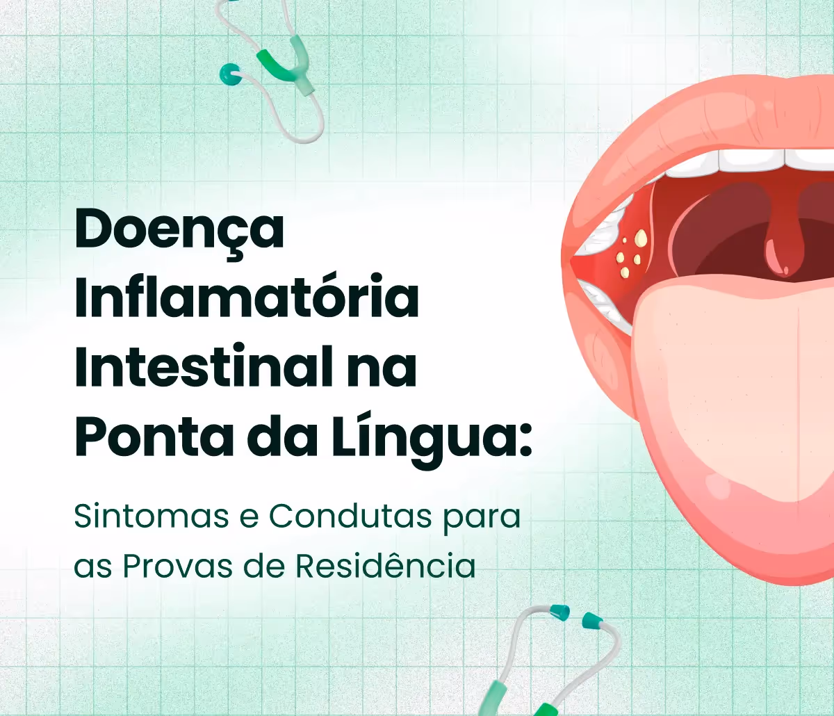 Doenças inflamatórias intestinais: o que cai na prova?