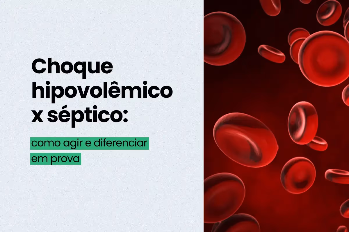 Choque hipovolêmico x séptico: diferenças, condutas e pegadinhas de prova