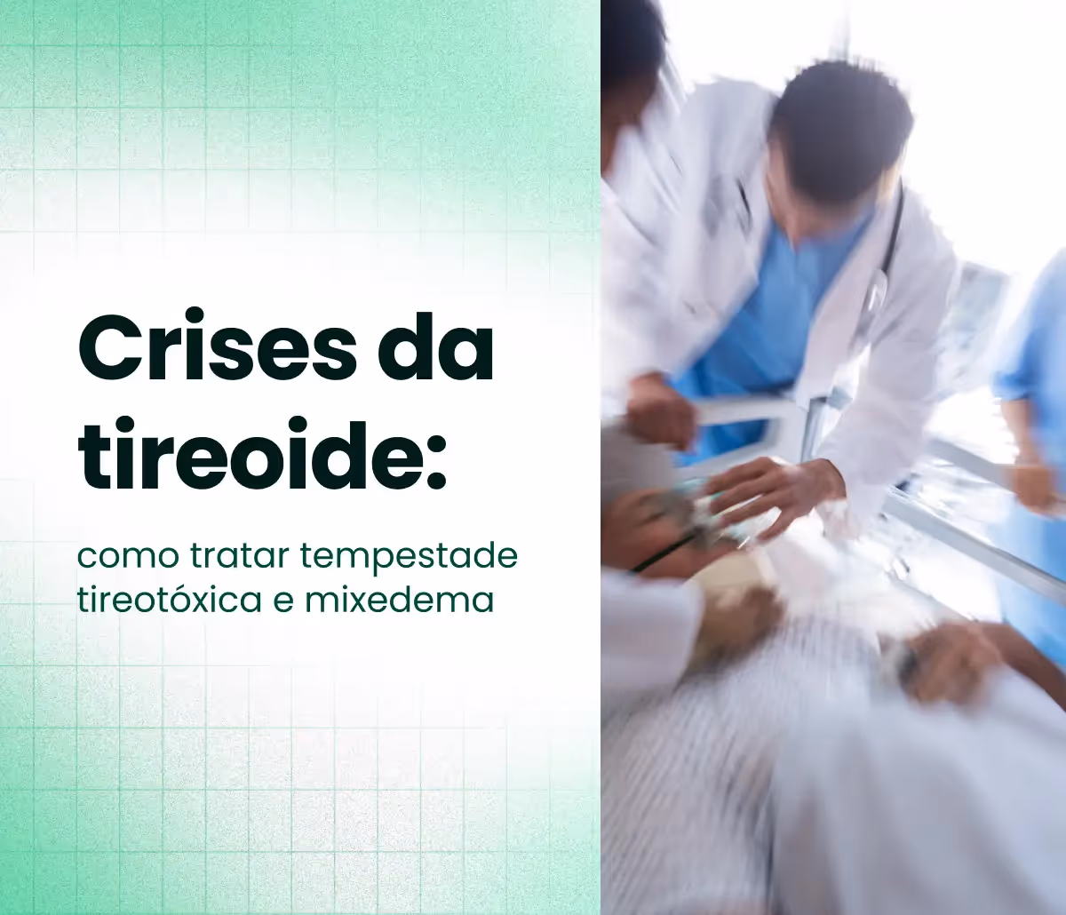 Crises da tireoide: como tratar tempestade tireotóxica e mixedema