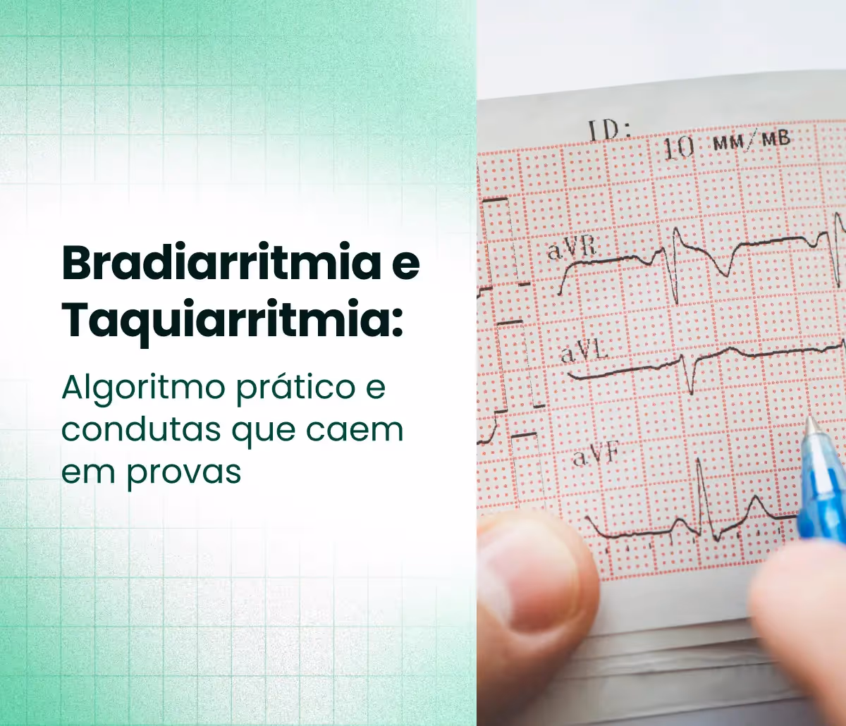 Como resolver questões de bradicardia e taquicardia na residência médica