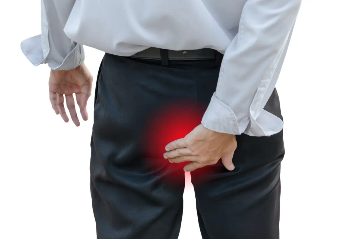 Abscesso perianal: o que é, causas, sintomas e como tratar
