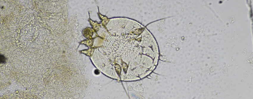 Imagem da visualização em microscópio do Sarcoptes scabiei var. homini