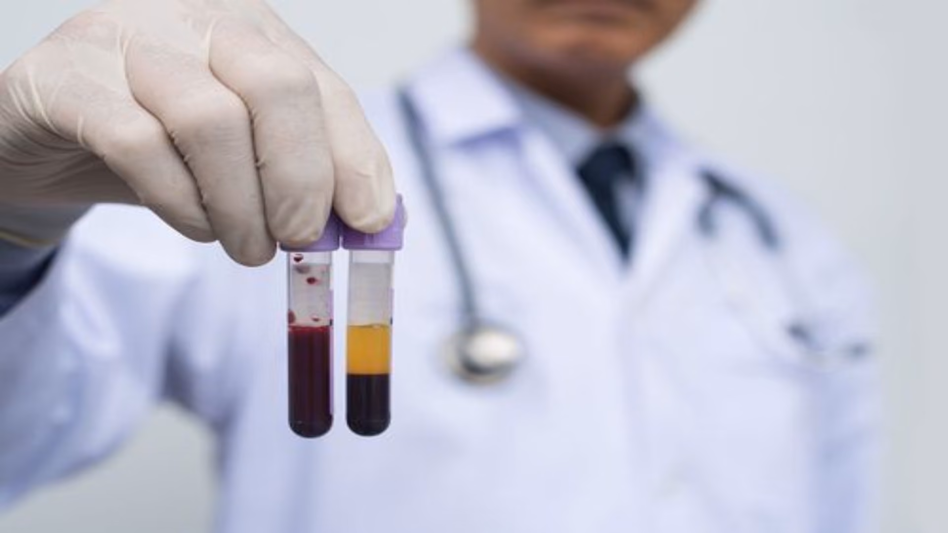 Hematologia e Hemoterapia: residência médica, áreas de atuação e rotina