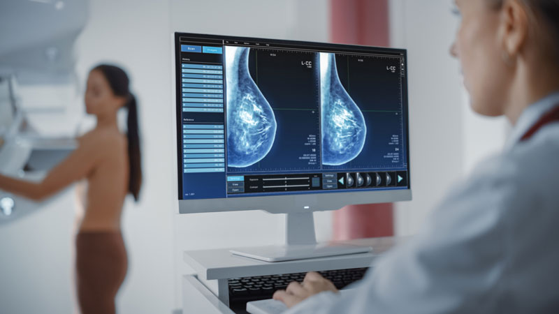 Os radiologistas não só laudam, como podem realizar mamografias. Foto: Reprodução/Shutterstock