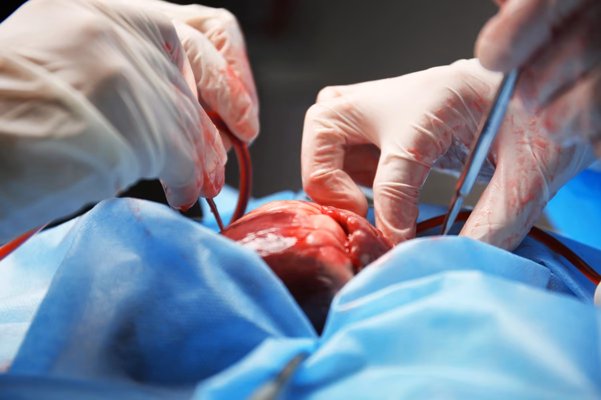 Residência Médica em Cirurgia Cardiovascular: rotina e salário