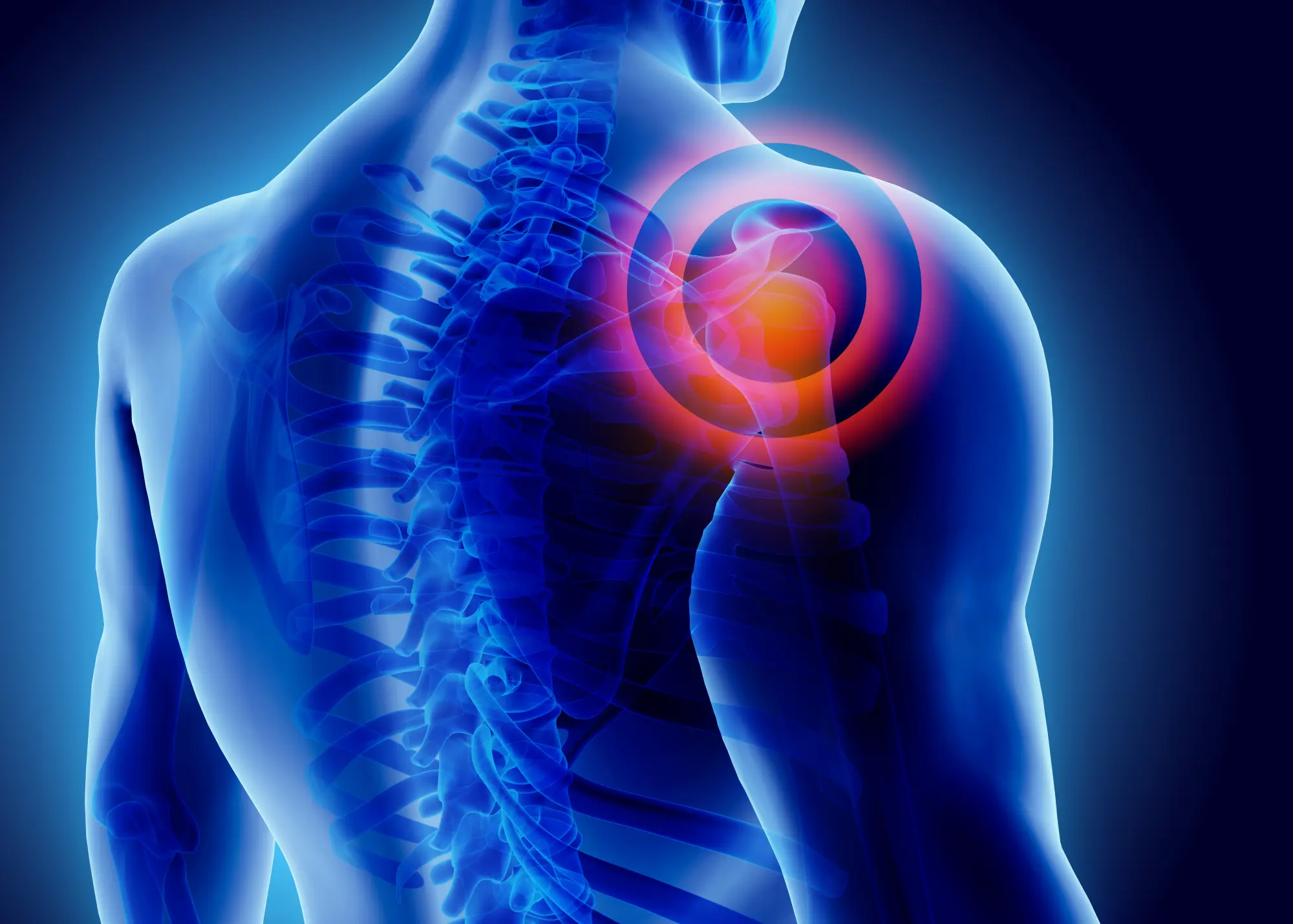 Shoulder Pain? Here’s How Chiropractic Care Can Help in Santa Maria