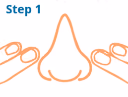 Cottle Maneuver Step 2