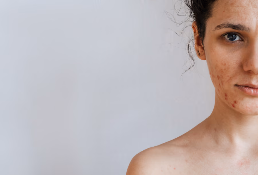 How to balance your hormones using a CGM
