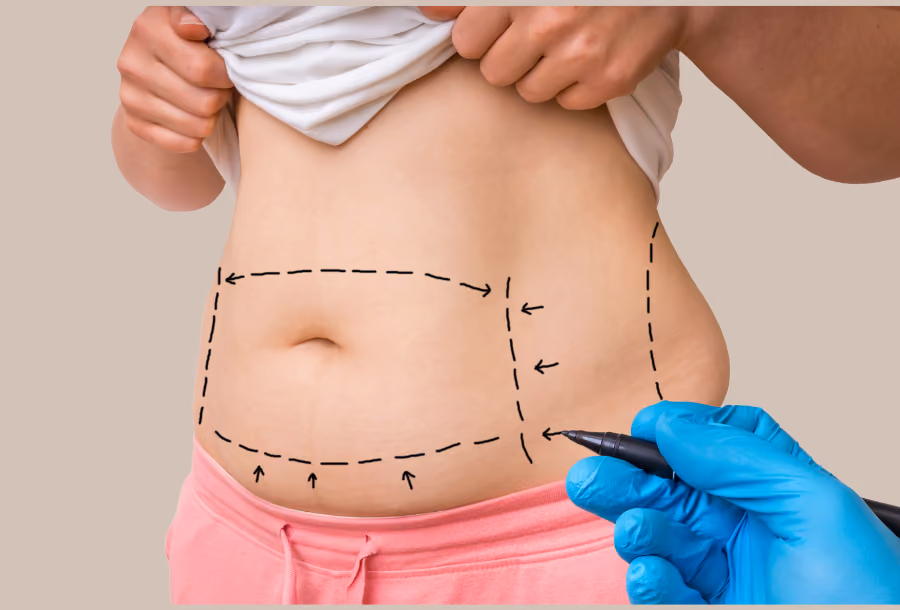 Everything you need to know about weight loss surgery in Australia