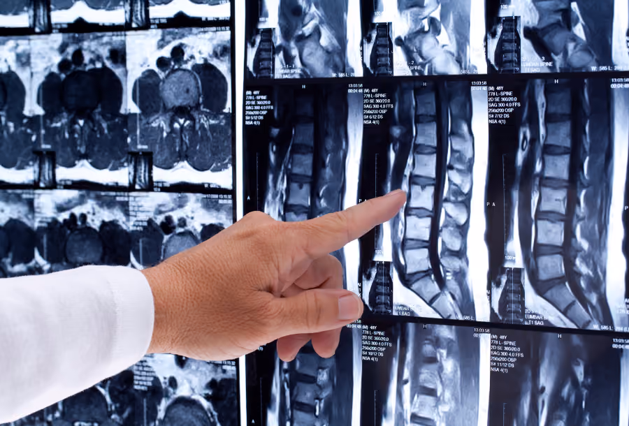 What is a fully body MRI Scan in Australia, and is it worth it