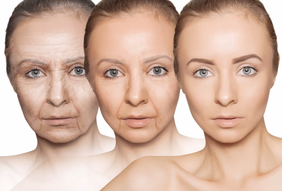 What is your bioage?