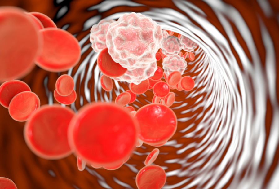 Chronic inflammation and CRP: the blood test that reveals it