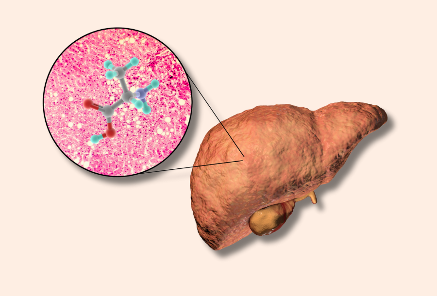 Alanine Aminotransferase Blood Test in Australia