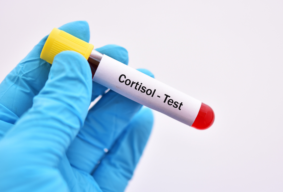Cortisol blood test Australia | cost and guide