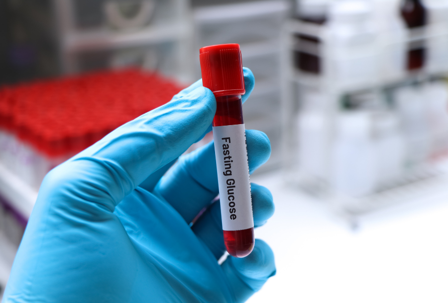 Fasting Glucose blood test Australia | guide and costs