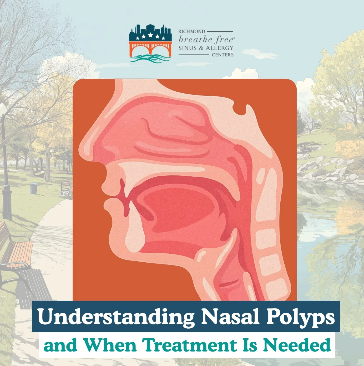 Understanding Nasal Polyps and When Treatment Is Needed