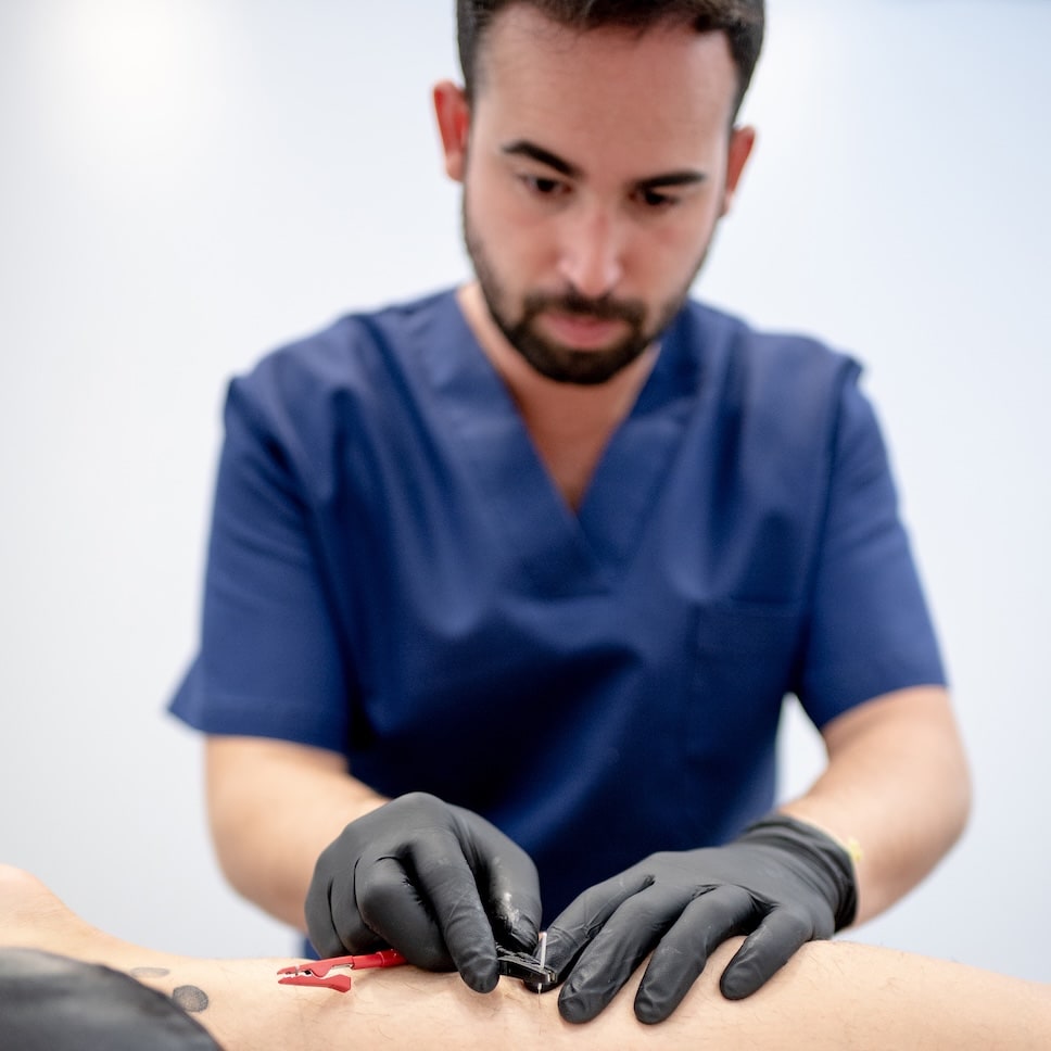 Fisioterapeuta aplicando técnica invasiva para el tratamiento del dolor crónico
