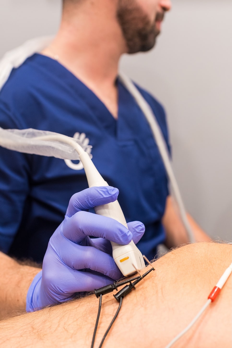 Neuromodulación percutánea guiada por ecografía aplicada en sesión de fisioterapia