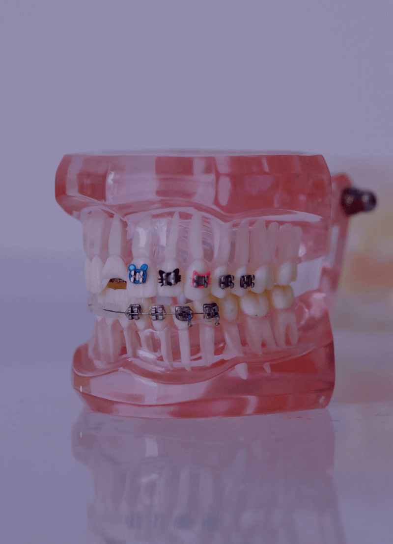 Wist je dat er metalen bestaan die je helemaal kan vervormen, maar die meteen weer hun oorspronkelijke vorm aannemen als je ze in water legt? Geheugenmetaal, heet dat. En die technologie kan gebruikt worden om robots spieren te geven en je beugel automatisch aan te spannen. UAntwerpen-fysicus Nick Schryvers neemt ons mee naar een wereld waarin je metalen kunstjes kan leren.