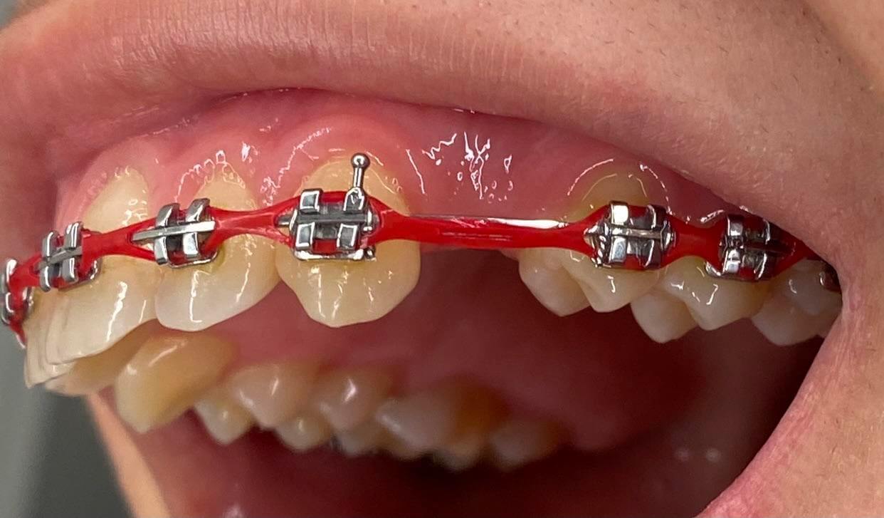 Visual representation of blog post content