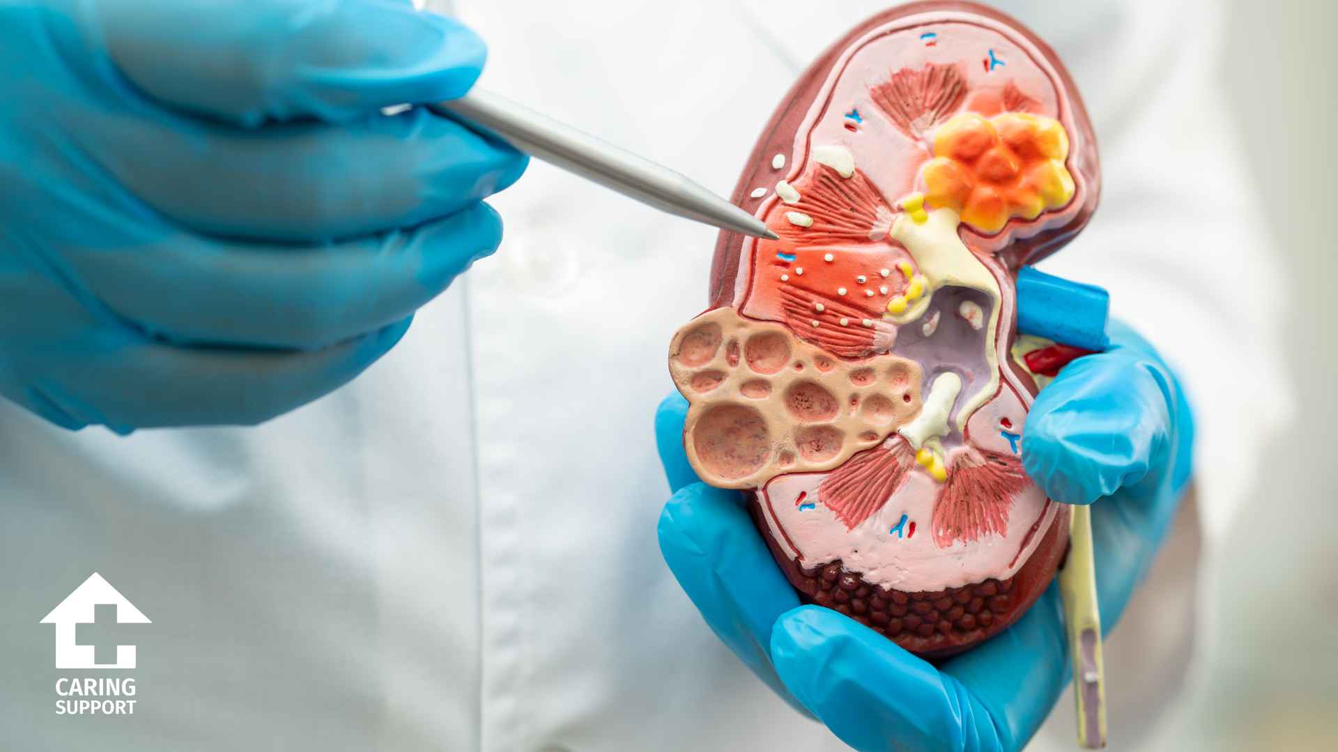 Chronic Kidney Disease