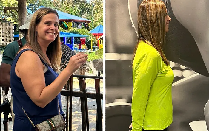 Client before and after, 40 lb weight loss