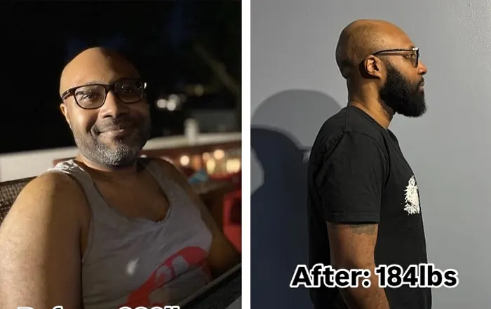 Client before and after, dropped 60 lbs