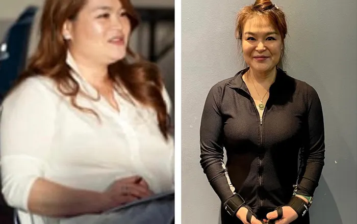 Client before and after, 45 lb weight loss