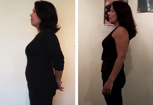 Before and after 30 lb weight loss transformation, UTG Personal Training client in Westwood NJ