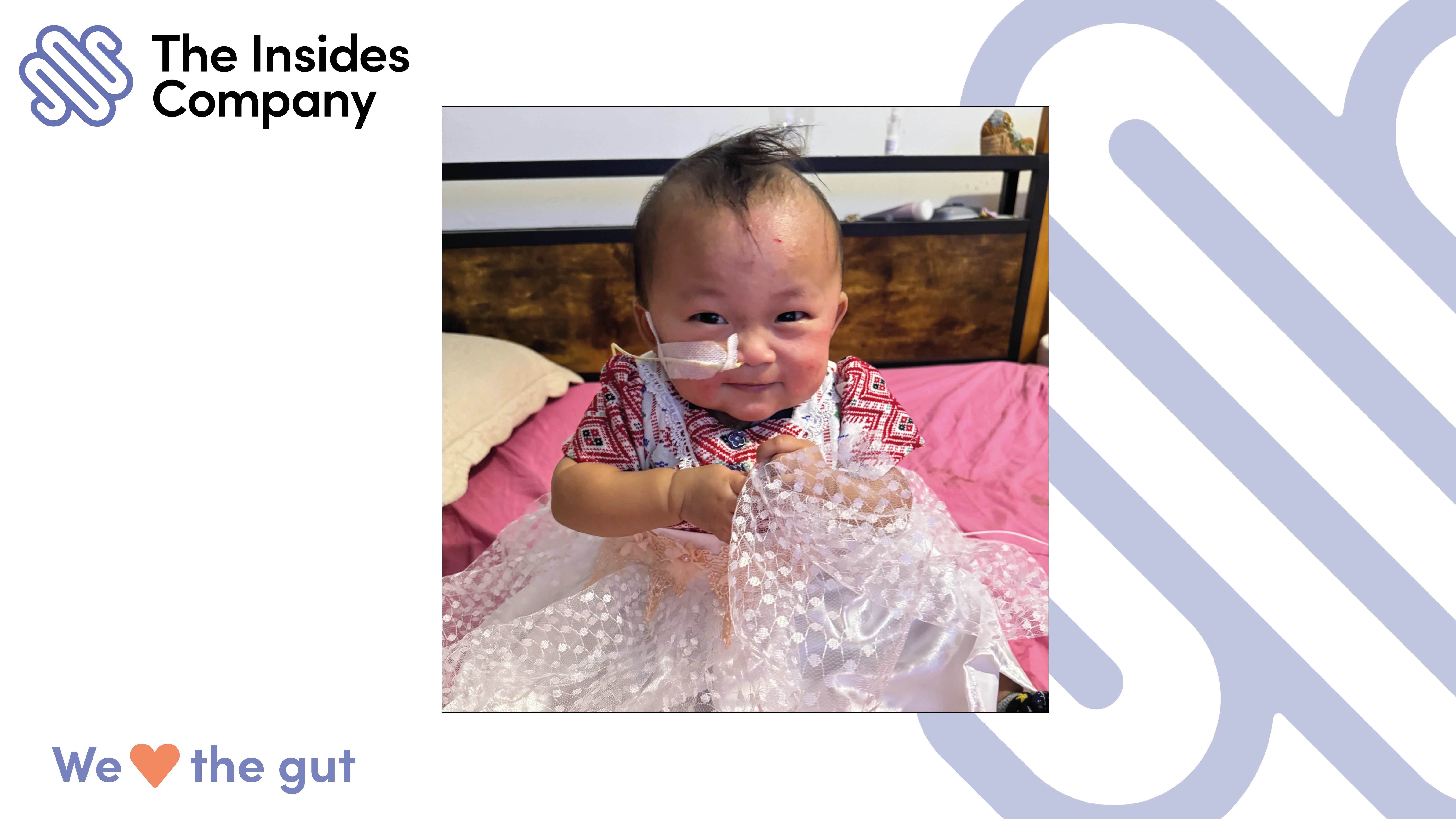 This case study follows Jaybie, a preterm infant born with gastroschisis who required multiple abdominal surgeries and experienced a complex postoperative course. She developed intestinal failure, became dependent on intravenous nutrition, and faced a long and challenging path to discharge...